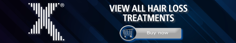 hair loss treatments