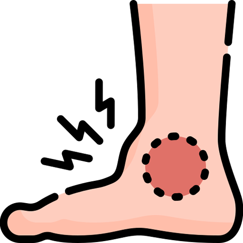 treatments and prescriptions for Gout treatments and prescriptions for Gout
